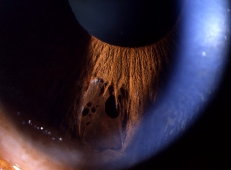 Advanced eye examination